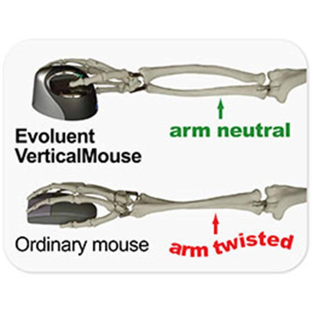 VerticalMouse 4 Right Bluetooth M179